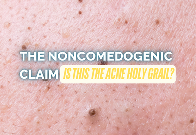 NONCOMEDOGENIC IS BEST FOR ACNE PRONED SKIN… RIGHT?